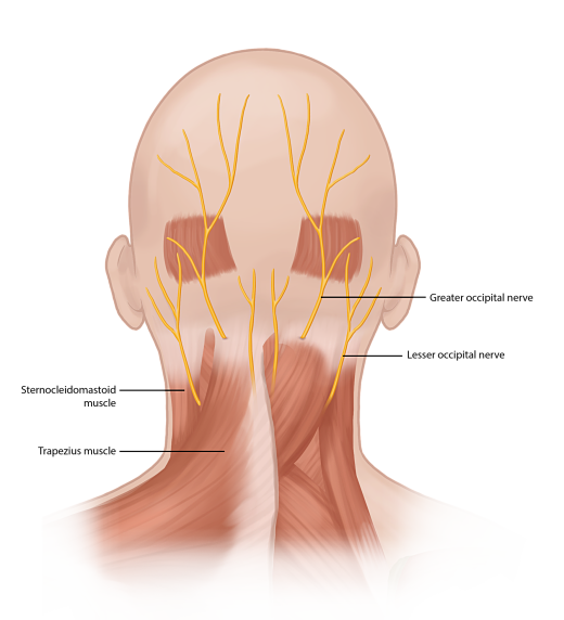 Occipital Neuralgia