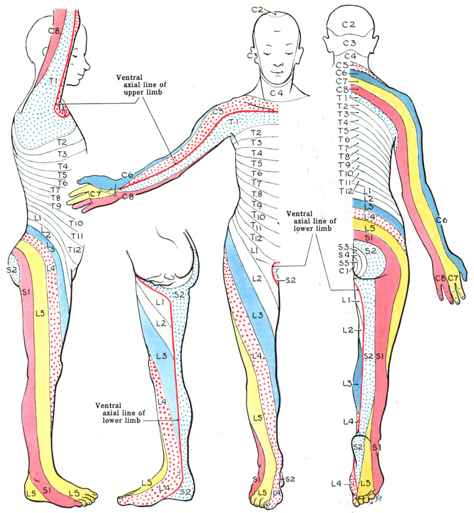 Radiculopathy