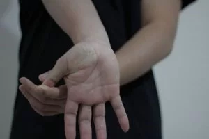 Sindromul de tunel carpian