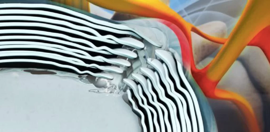 Diagnostic si tratament pentru afectiuni spinale complexe