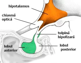 Adenom hipofizar