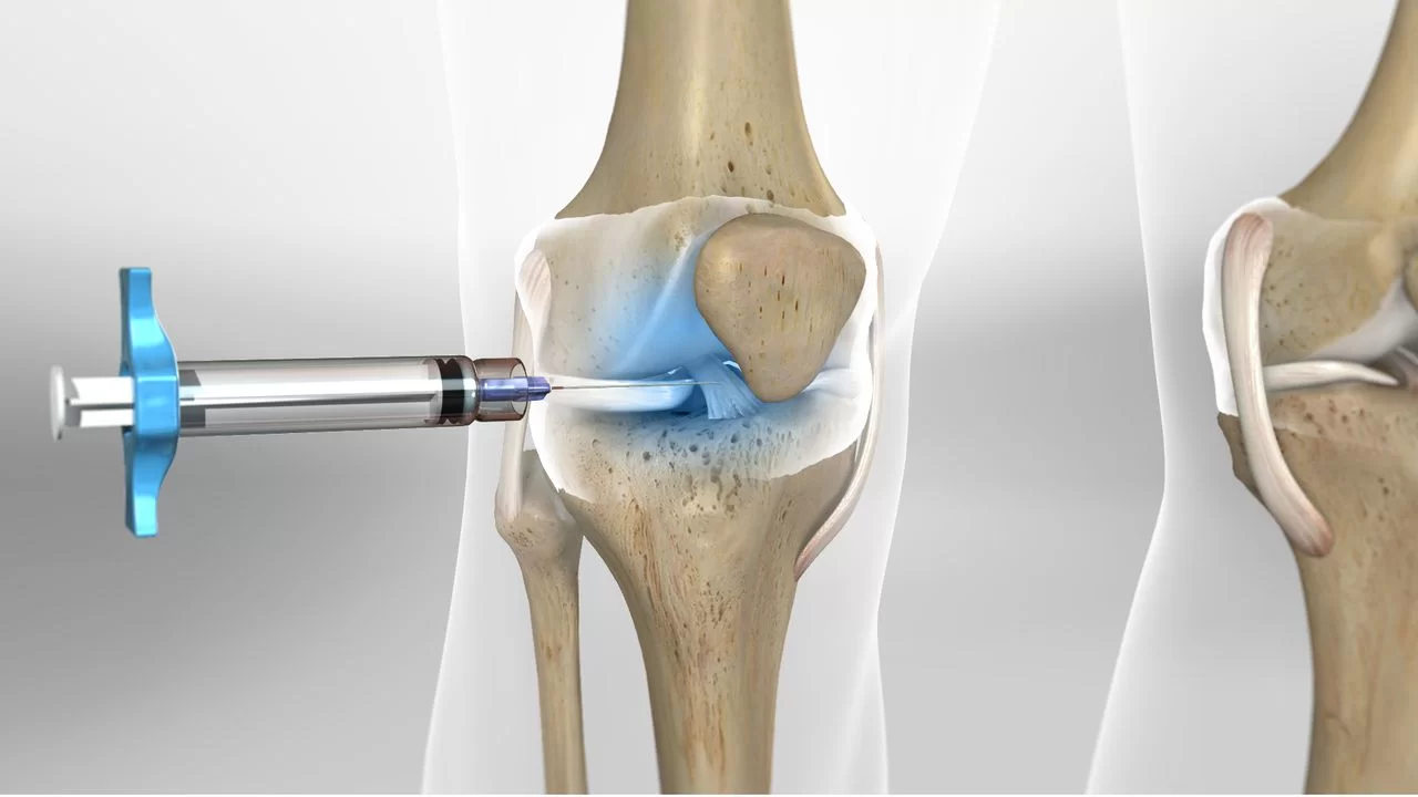 artroza deformantă a articulației încheieturii stângi tratamentul artritei de gradul 2 al articulației genunchiului