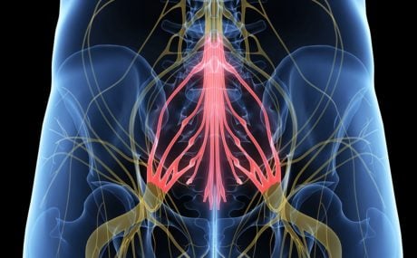 Abordarea neurochirurgicală pentru sindromul „coadă de cal” 
