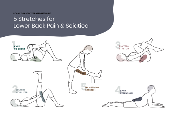 Sciatica
