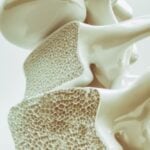 Osteomielita vertebrală