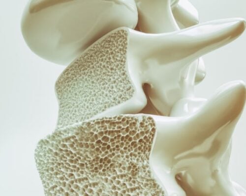 Totul despre osteomielita vertebrală