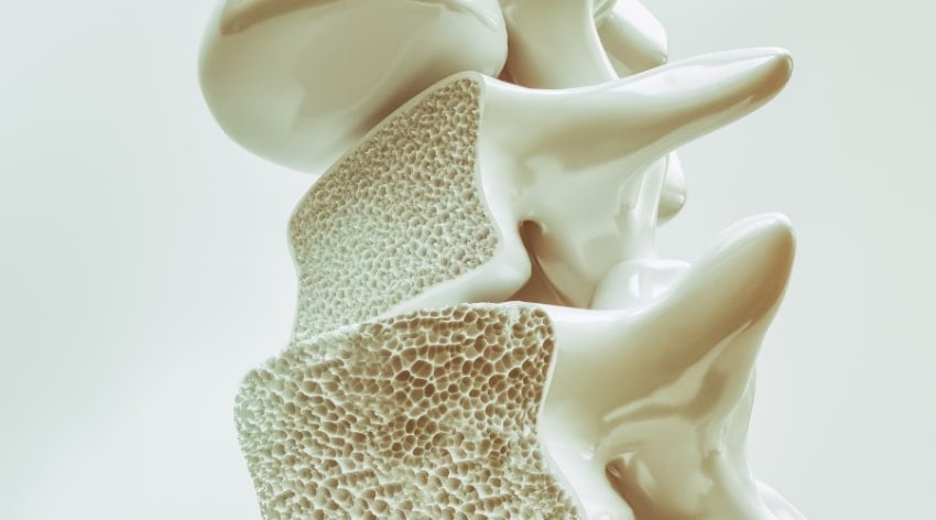 Osteomielita vertebrală