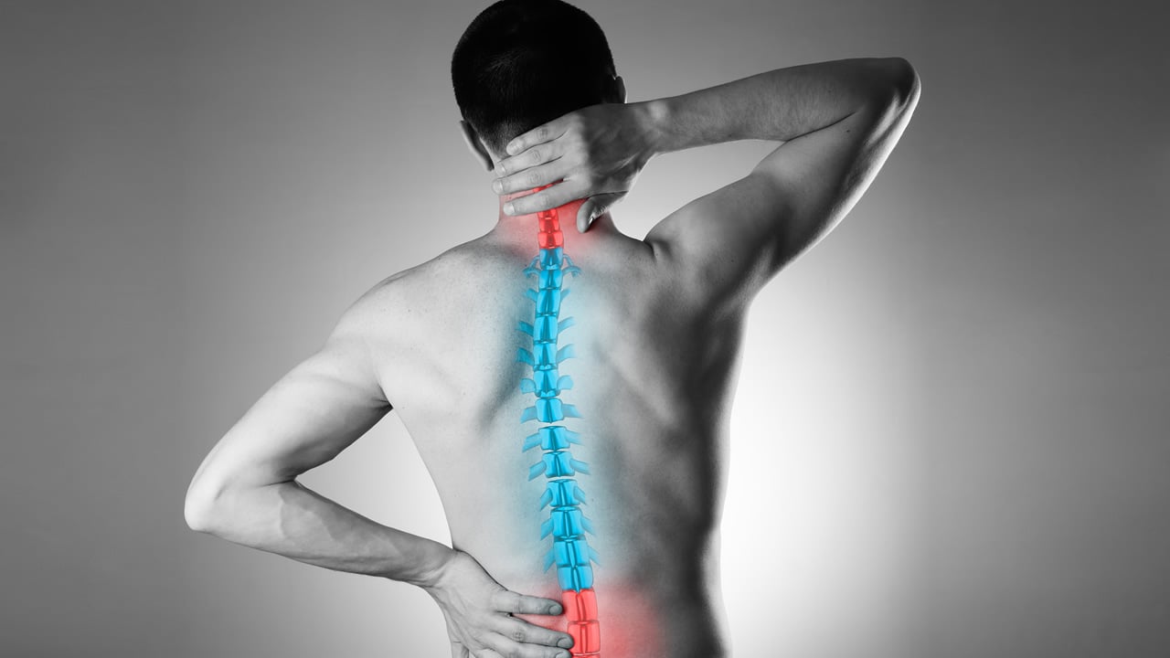 vertebroplastia