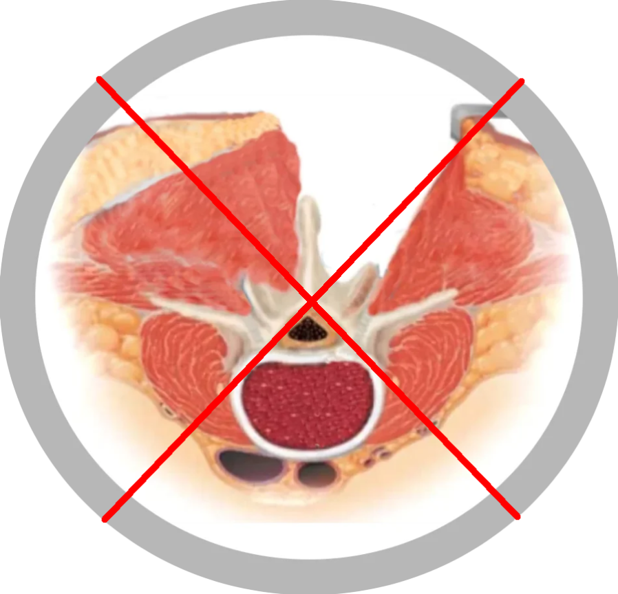 chirurgie spinala - tehnica clasica (1)
