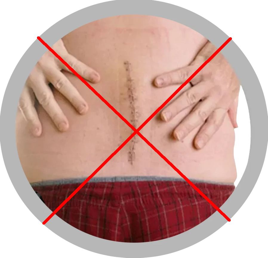 chirurgie spinala - tehnica clasica (2)