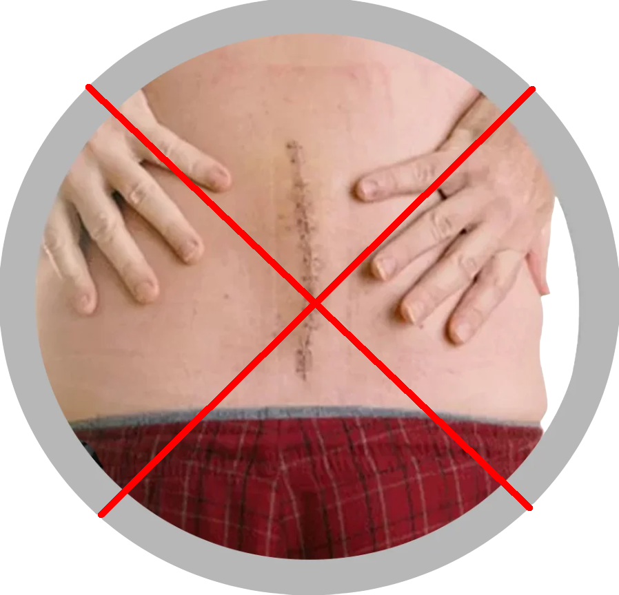 protezare spinala - tehnica clasica (1)